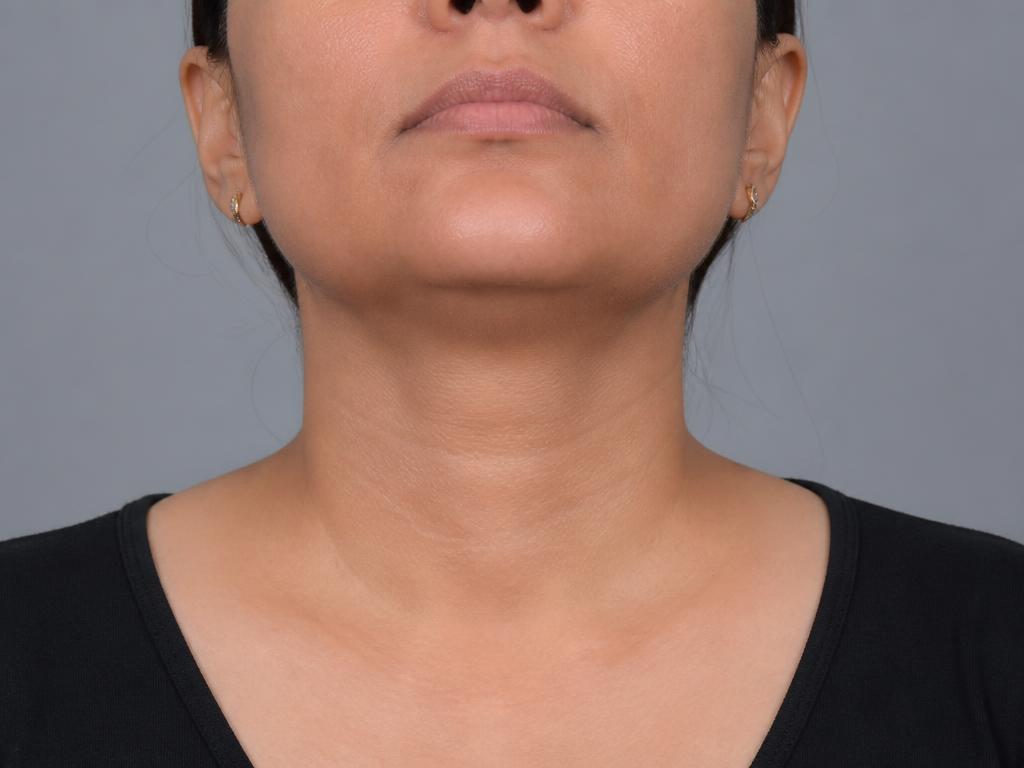 Internal Medicine — Thyroid Treatment — after treatment